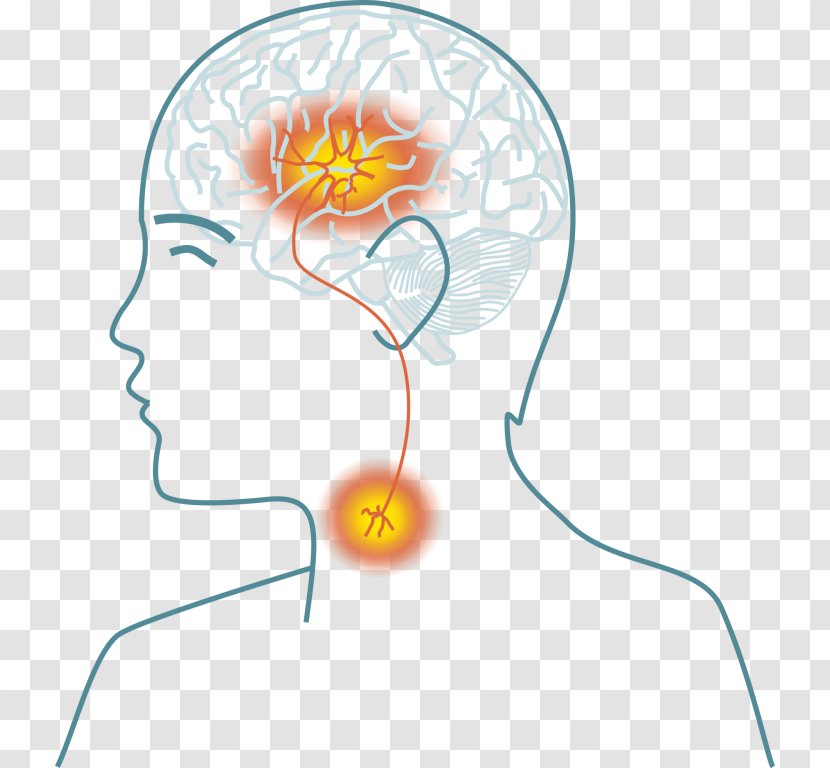 Dysphagia Transient Ischemic Attack Stroke Symptom Brain - Cartoon Transparent PNG