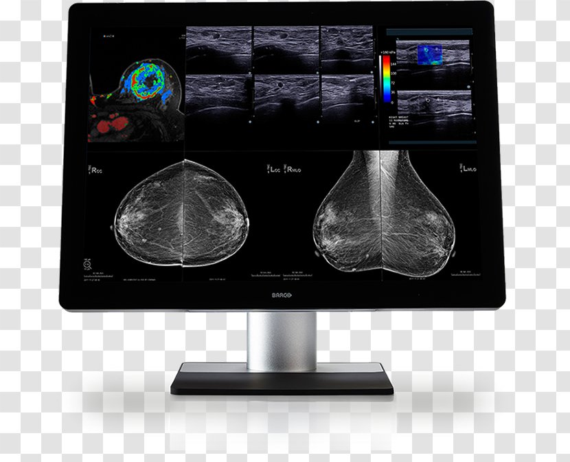 Computer Monitors Barco Digital Mammography Medical Imaging - Smooth Sailing Transparent PNG