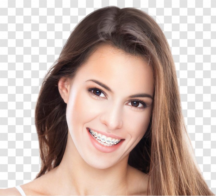 Cosmetic Dentistry Orthodontics Palms Dental Centre - Face - Smile Transparent PNG