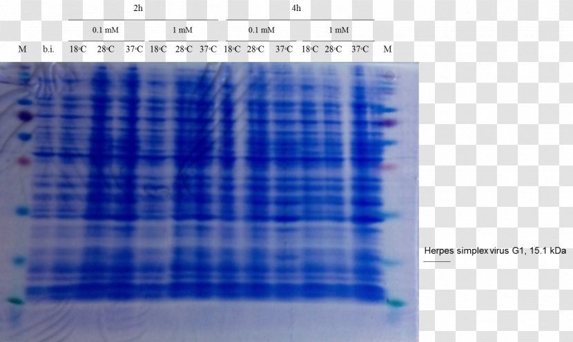 Western Blot Cell SDS-PAGE Staining Polyacrylamide Gel Electrophoresis - Membrane - Herpes Simplex Virus Transparent PNG