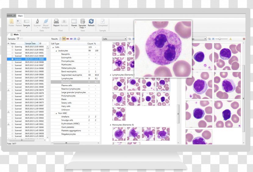 Hematology Complete Blood Count White Cell Microscope - Clinical Urine Tests Transparent PNG