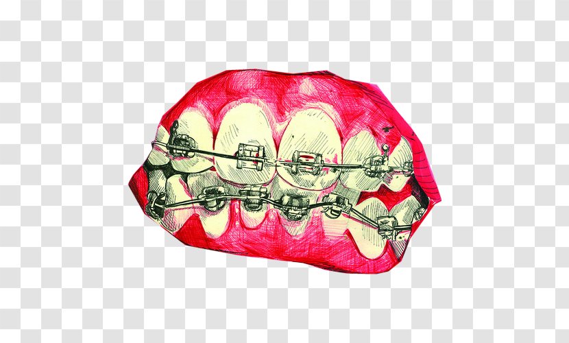 Mouth Tooth Sinful Folk: A Novel Of The Middle Ages Dental Braces - Data Compression - Lip Transparent PNG