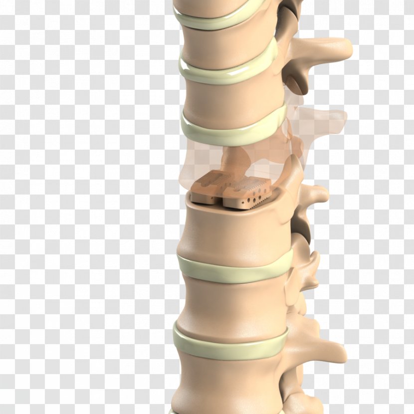 Titanium Ti-6Al-4V ISO 5832 Anatomy Material - Lumbar Transparent PNG