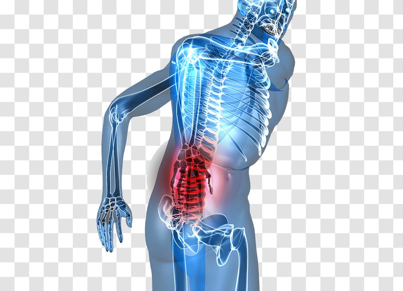 Low Back Pain Sciatica Chiropractic Chiropractor - Hip - Human Leg Transparent PNG