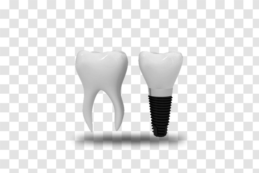 Tooth Dental Implant Dentistry Orthodontics - Frame - Tree Transparent PNG