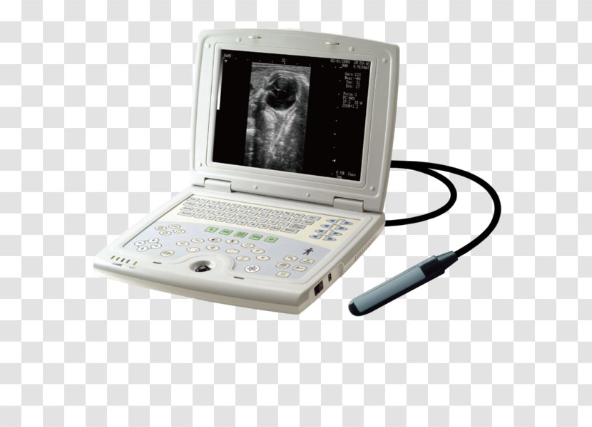 3D Ultrasound Ultrasonography Diagnostic Equine - Technology - Ultra Sound Transparent PNG