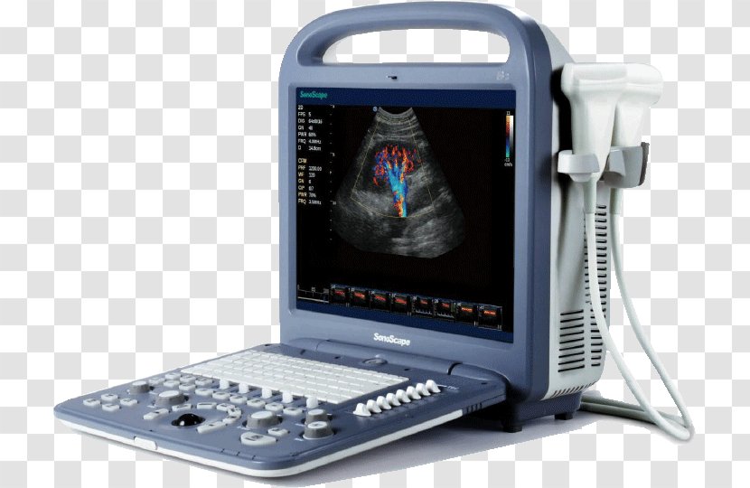 Doppler Echocardiography Portable Ultrasound Ultrasonography SonoScape Medical Corp - Medicine Transparent PNG