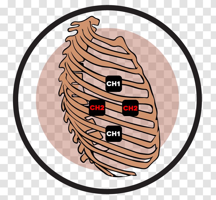 Rib Cage Transcutaneous Electrical Nerve Stimulation Vertebral Column Muscle - Subluxation - Cervical Vertebrae Transparent PNG