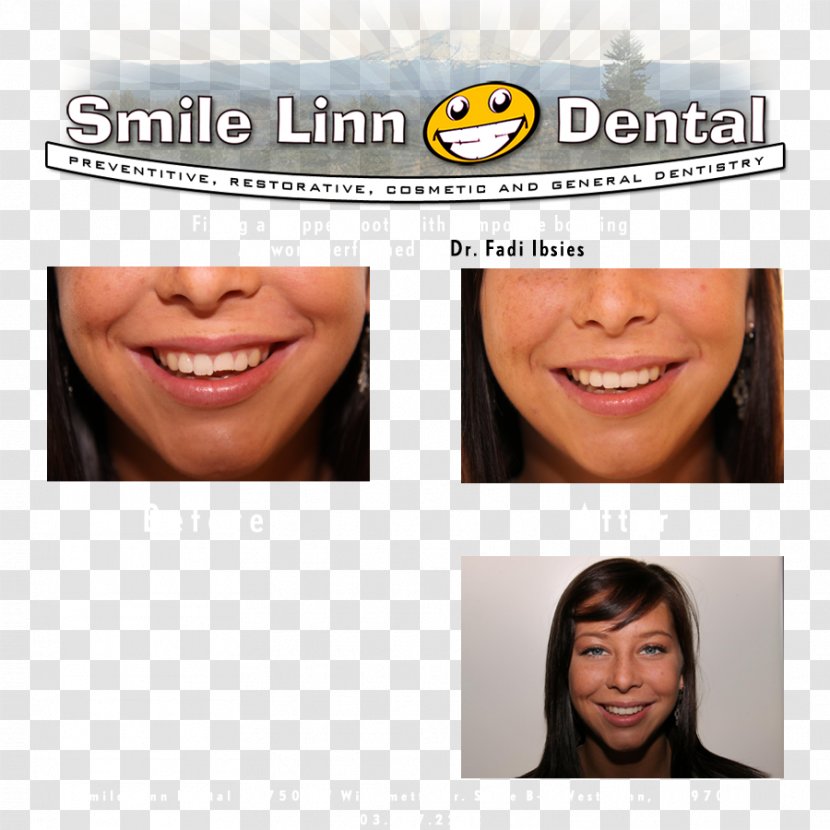 Lake Oswego Smile Linn Dental: Ibsies Fadi B DMD Willamette River Dentist Willamette, Oregon - Nose - Dental Transparent PNG