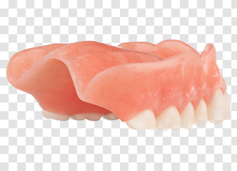Tooth Dentures - Aspen Dental Transparent PNG