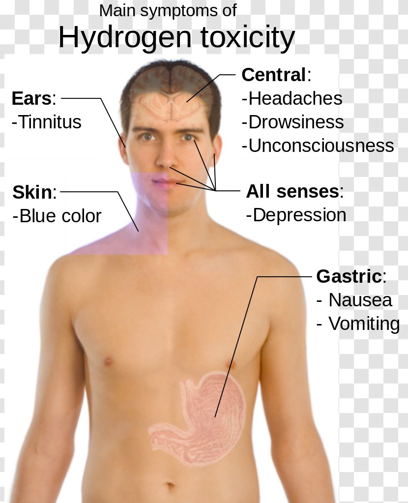 Symptom Health Disease Iron Deficiency Multiple Sclerosis - Heart Transparent PNG