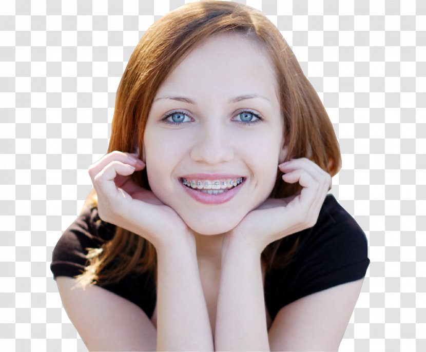 Dental Braces Orthodontics Clear Aligners Damon System Dentistry - Tree Transparent PNG