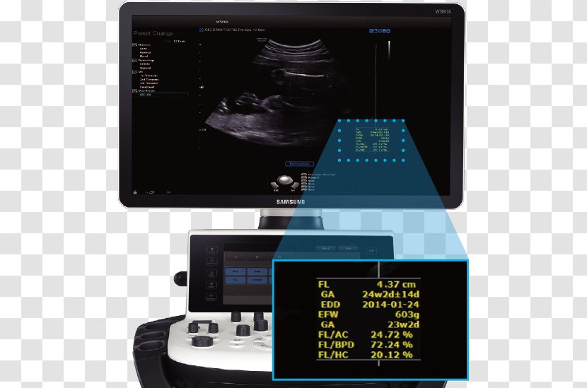 3D Ultrasound Samsung Medison Ultrasonography Consumer Electronics Transparent PNG