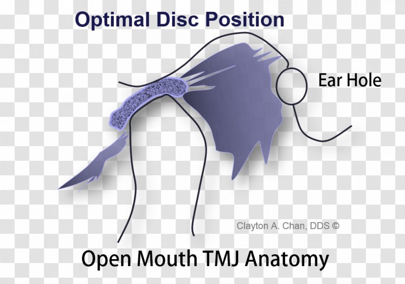 Temporomandibular Joint Dysfunction Anatomy Mandible - Frame - Skull Transparent PNG
