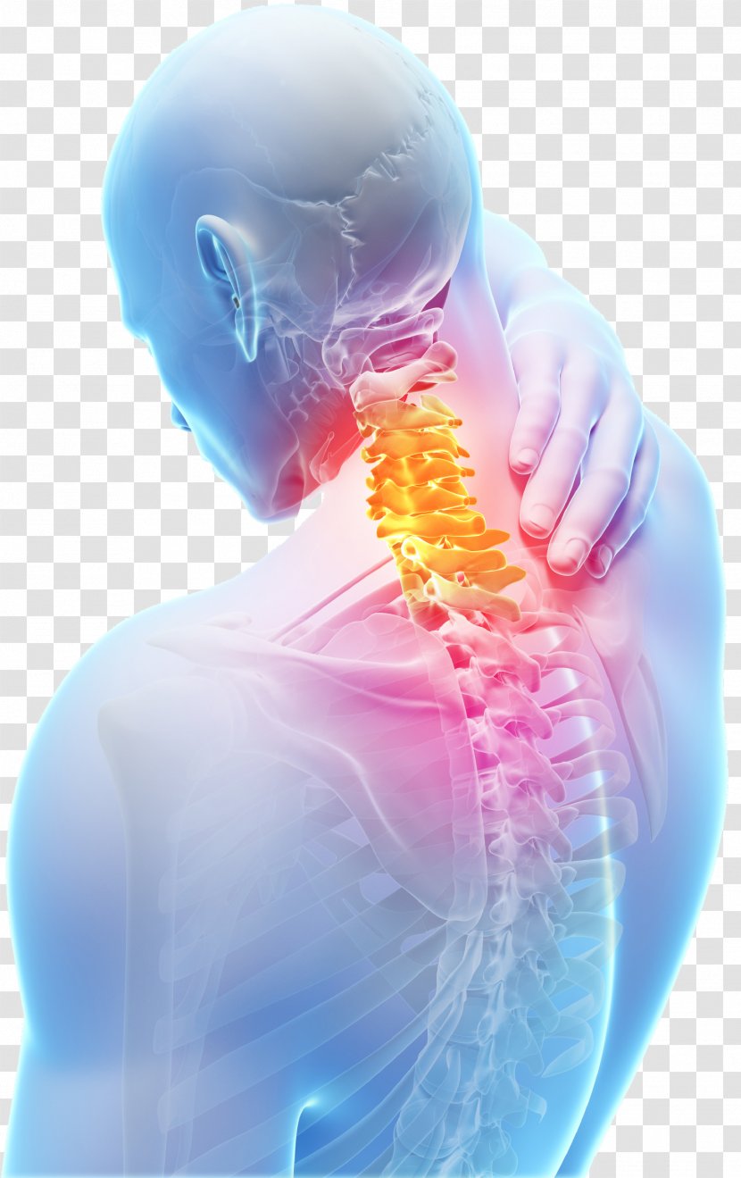Neck Pain Spinal Disc Herniation Cervical Vertebrae Vertebral Column Degenerative Disease - Jaw - Painful Transparent PNG