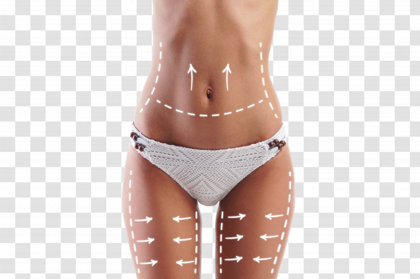 Weight Loss Adipose Tissue Liposuction Mud Wrap Cellulite - Heart - Arrow Female Body Transparent PNG