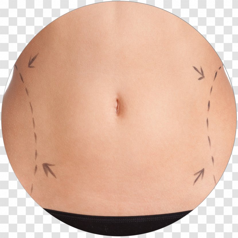 Stretch Marks Abdomen Abdominoplasty Navel Hip - Watercolor - Beauty Clinic Transparent PNG