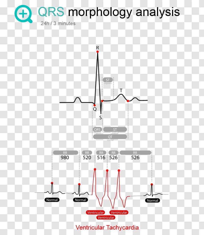 Line Point Angle - Area - Ecg Monitor Transparent PNG