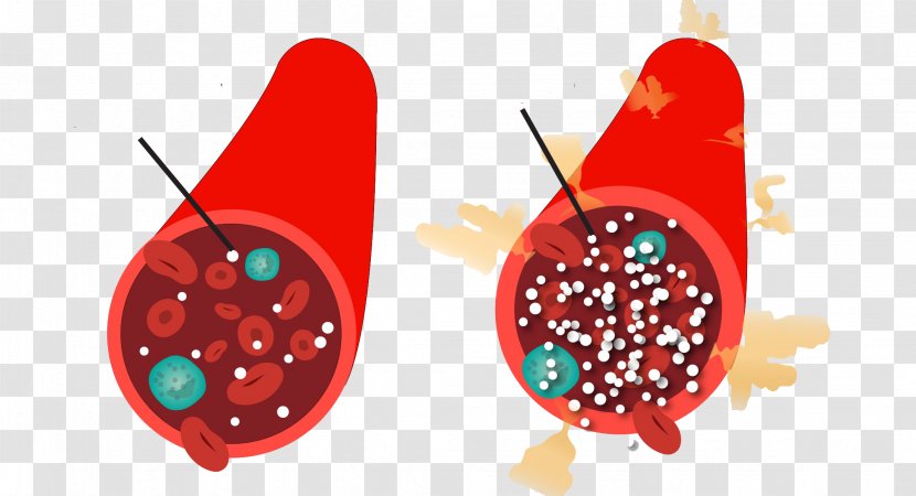 Blood Sugar Hyperglycemia Diabetes Mellitus Type 2 Glucose Monitoring - Diabetic Diet Transparent PNG