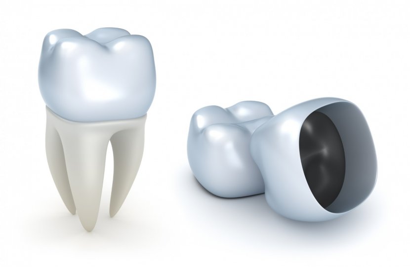 Crown Dentistry Teeth Cleaning Bridge - Heart Transparent PNG