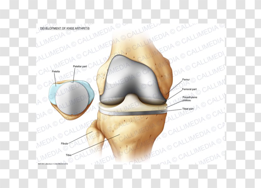 Bone Fracture Jaw Ear Human Tooth - Heart - Muscular Development Transparent PNG