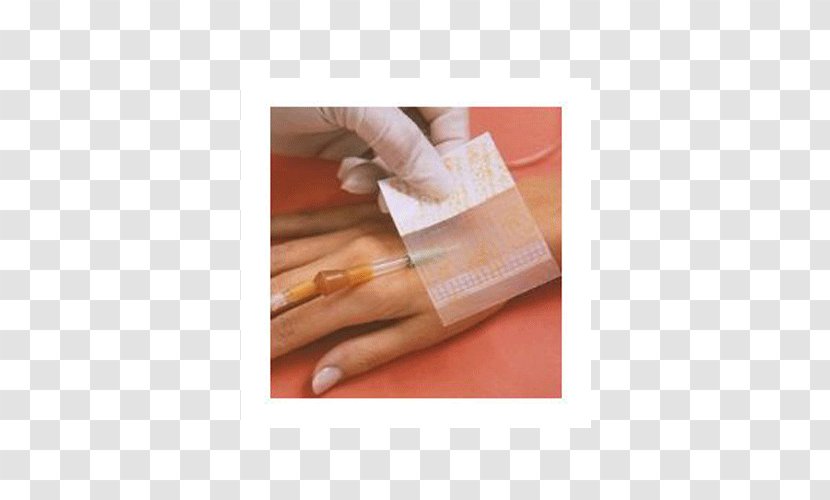 Intravenous Therapy Dressing Catheter Cannula Health Care - Medical Equipment - Wounds Transparent PNG
