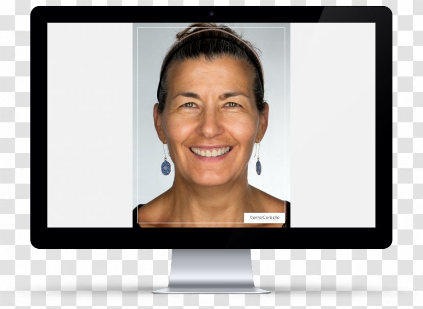 Computer Monitors Tooth Whitening Crown Veneer Multimedia - Media Transparent PNG