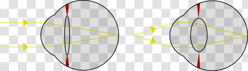 Lens Accommodation Refrazione Oculare Retina Cataract - Watercolor - Photosensitive Transparent PNG