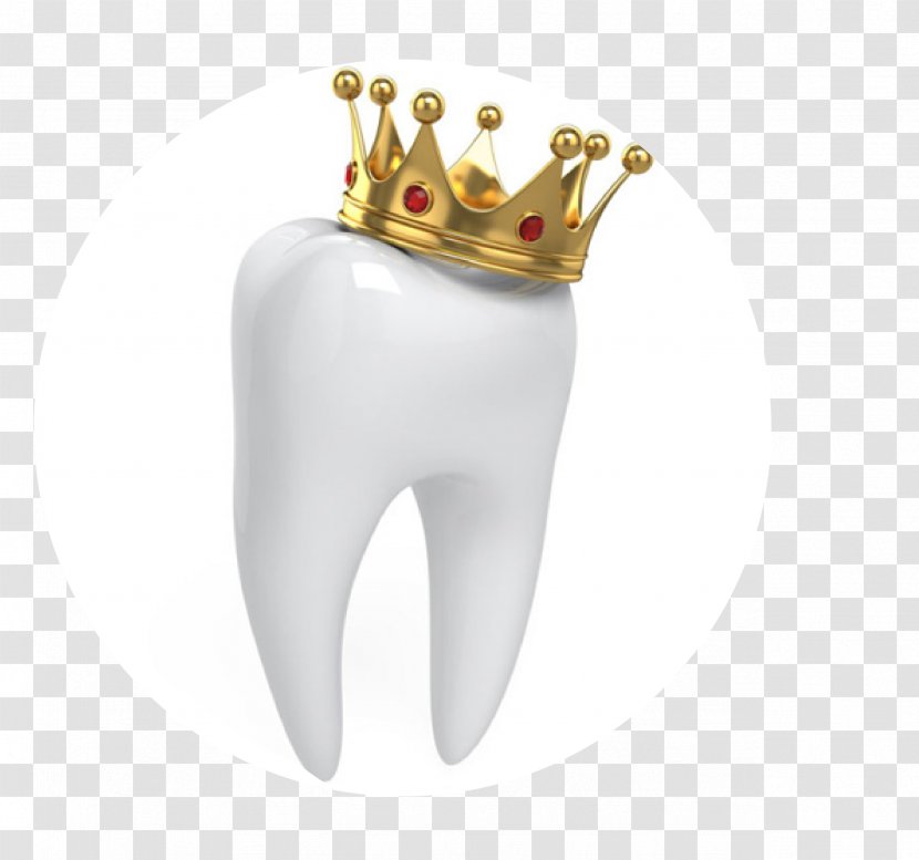 Crown Dentistry Human Tooth - Body Jewelry Transparent PNG