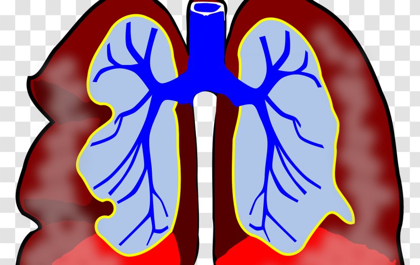 Cancer Awareness Ribbon Lung Clip Art - Silhouette - Dental Bacteria Transparent PNG