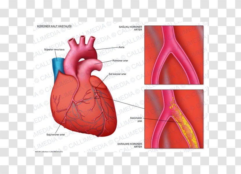 Coronary Artery Disease Arteries Cardiology Cardiovascular - Heart Transparent PNG