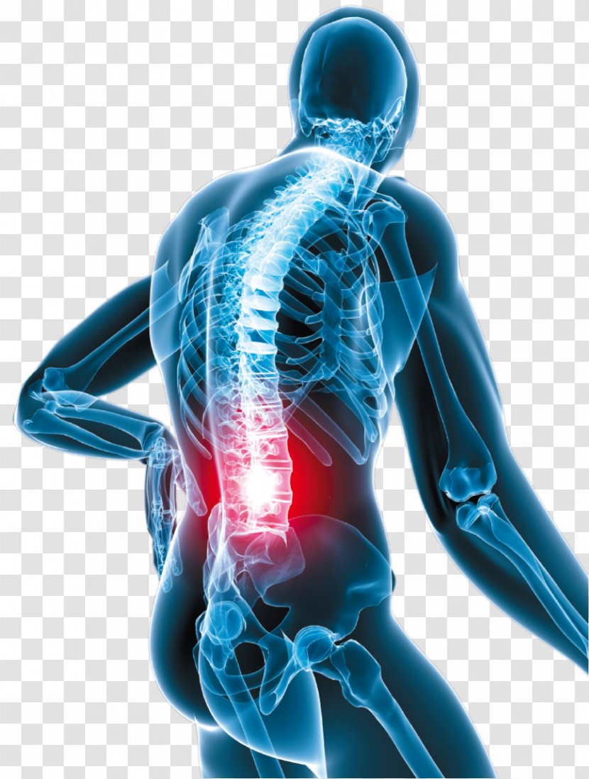 Low Back Pain Neck Oxycodone Human - Strain - Vertebral Transparent PNG