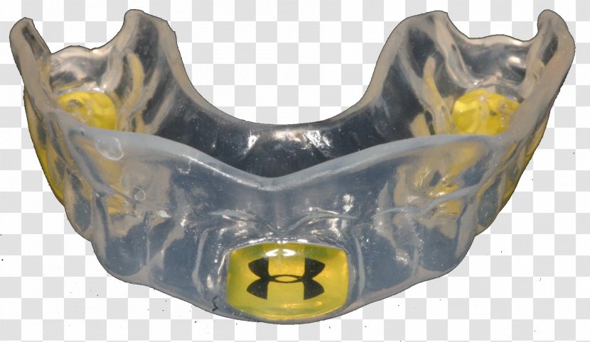 Mouthguard Dentistry Govan Dental Care Temporomandibular Joint Dysfunction - National Health Service - Bridge Transparent PNG