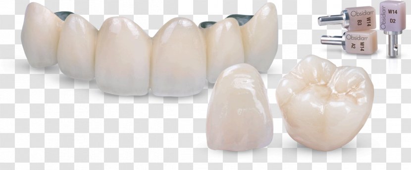 Tooth Ceramic Crown Dental Porcelain Transparent PNG