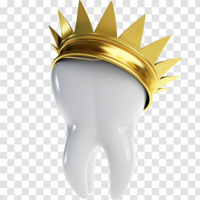 Dentistry Bridge Crown Dental Implant - Root Canal Treatment Transparent PNG