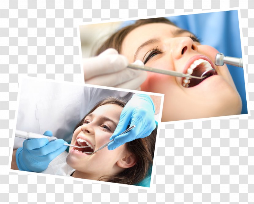 Dentistry Health Care Dental Implant Transparent PNG