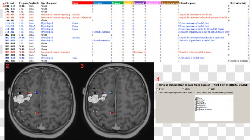 Medical Imaging Brain Positron Emission Tomography Magnetic Resonance Electrode - Cartoon Transparent PNG