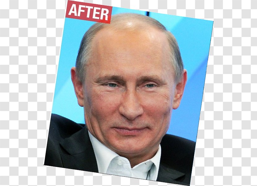Vladimir Putin President Of Russia Surgery - Politician Transparent PNG