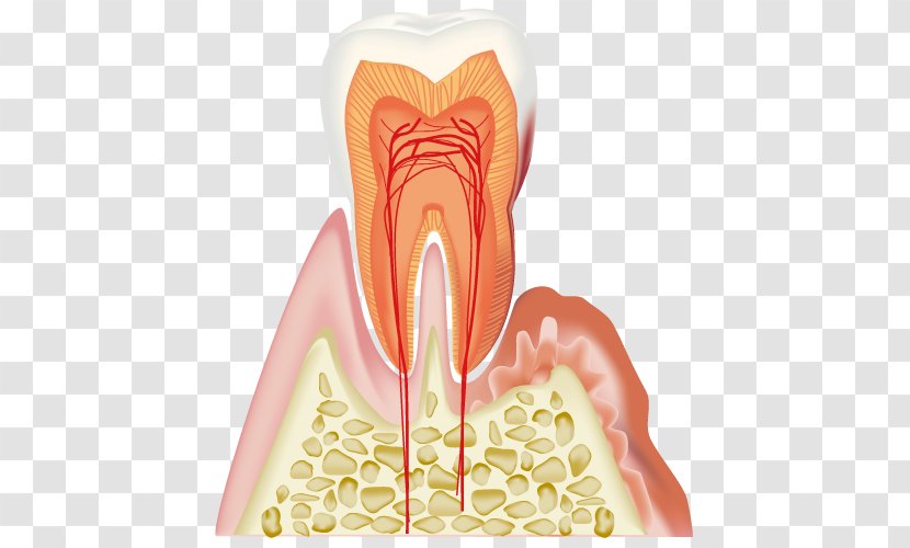 Periodontal Disease Dentistry Gums - Silhouette - Cartoon Transparent PNG