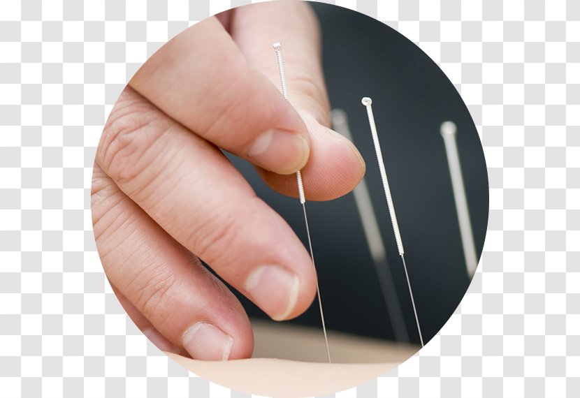 Acupuncture Traditional Chinese Medicine Naturopathy Dry Needling - Finger - Health Transparent PNG