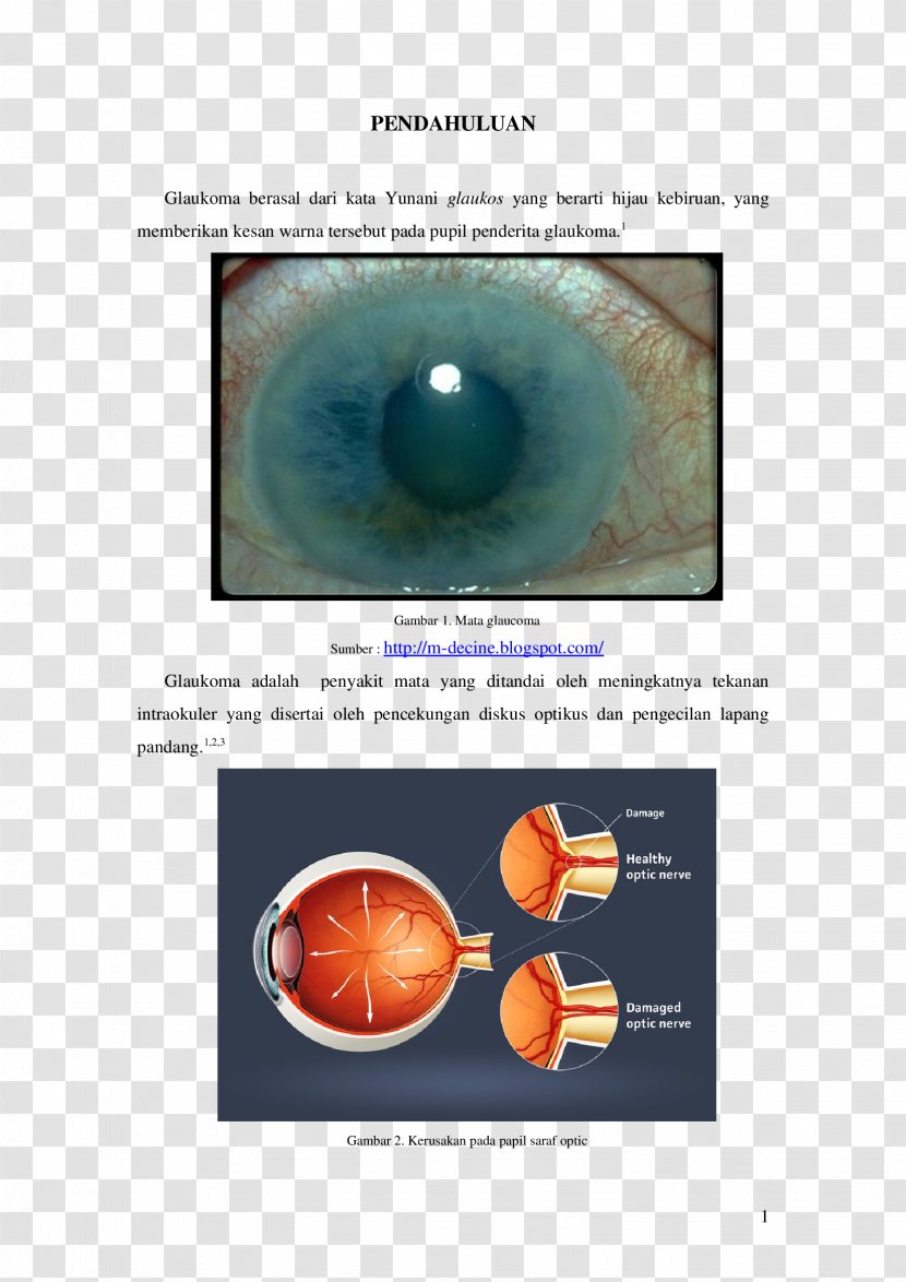 Close-up Optic Nerve - Silhouette - Gambar Target Transparent PNG