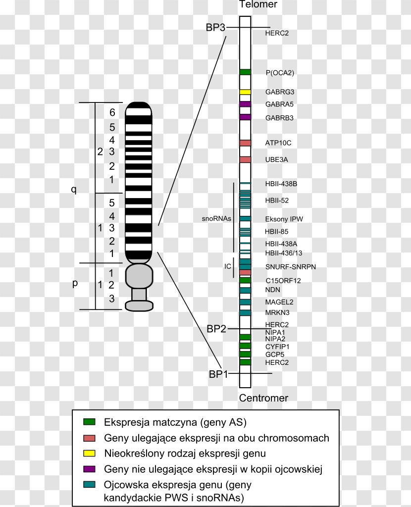Genetic Disorder Chromosome Disease Down Syndrome - Diagram - Scoliosis Transparent PNG