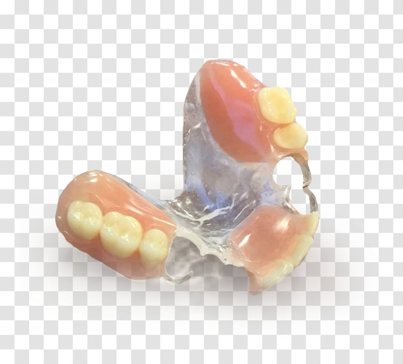 Dentures Tooth Dentistry Manufacturing Dental Impression - Prosthodontics - Partial Transparent PNG
