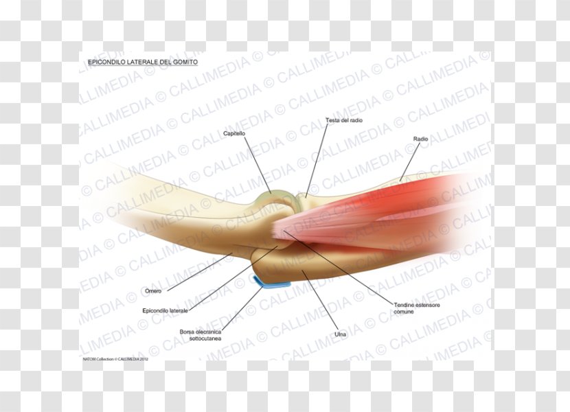 Lateral Epicondyle Of The Humerus Tennis Elbow Medial - Cartoon Transparent PNG