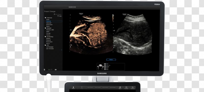 Contrast Agent Ultrasonography Ultrasound Radiography Medical Imaging - Computed Tomography - Hinh Bong Hoa Dao Transparent PNG