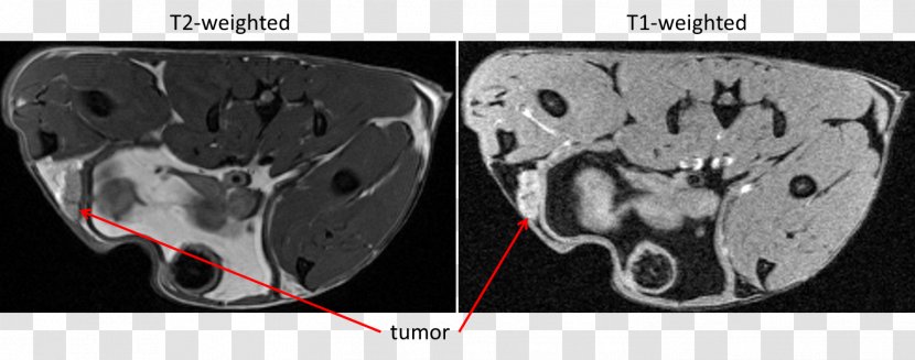 Computed Tomography Magnetic Resonance Imaging Spin–spin Relaxation Brain Tumor Gradient Echo - Cartoon - Mouse Transparent PNG