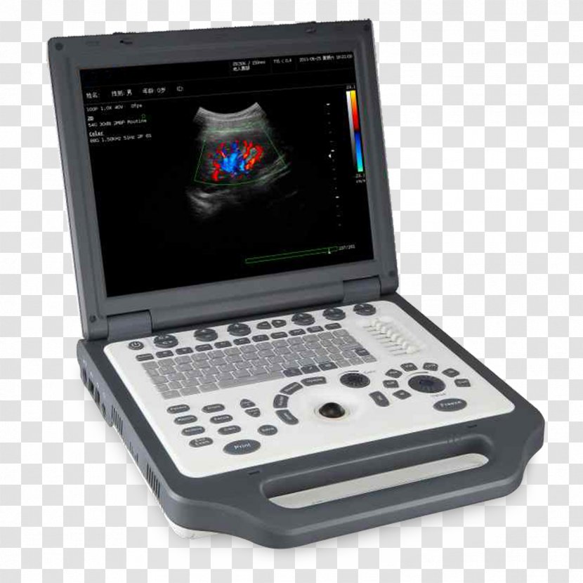 Ultrasonography Ultrasound Doppler Echocardiography Medical Equipment Medicine - Electronic Instrument - Sina Weibo Qq Space Wechat Transparent PNG