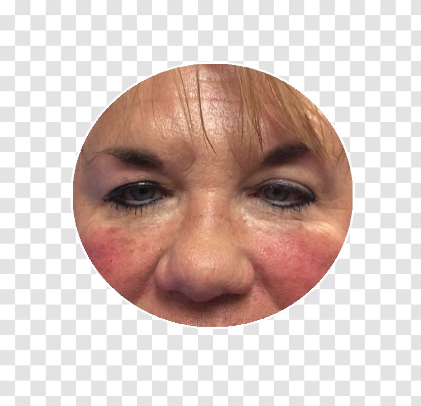 Fusion Medical Aesthetics Nose Eye Dr. Lisa L. Gardner, OB-GYN Cheek - Face Transparent PNG