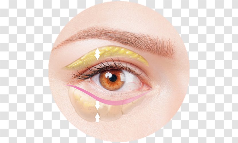 Face Eye Skin Enophthalmia Medicine - Double Eyelids Transparent PNG