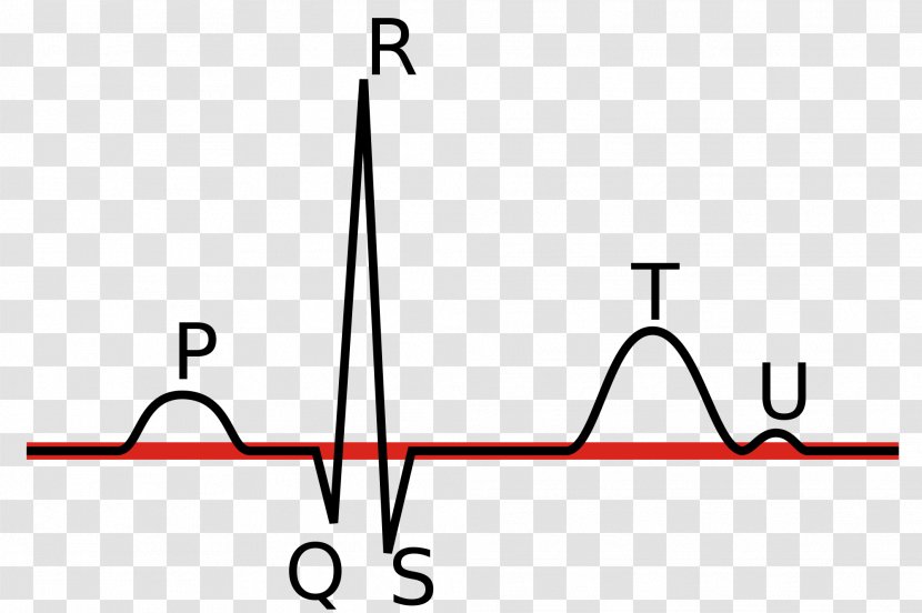 Electrocardiography Linia Izoelektryczna P Wave QRS Complex Heart Rate - Ekgmonitoring Transparent PNG